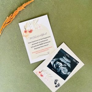 En Özel Duygu Bebek Müjde Kartı – Baba Oluyorsun