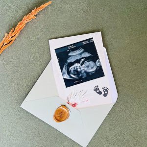 En Özel Duygu Bebek Müjde Kartı – Baba İçin