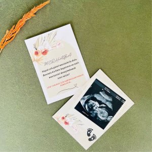 En Tatlı Mucize Bebek Müjde Kartı – Baba İçin