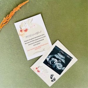 En Tatlı Mucize Bebek Müjde Kartı – Baba Oluyorsun