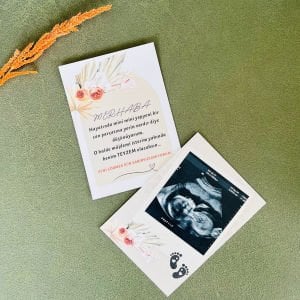 Yepyeni Bir Can Parçası Bebek Müjde Kartı - Teyze İçin