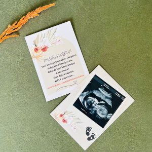 Yeni Bir Neşe Kaynağı Bebek Müjde Kartı  – Hala Oluyorsun