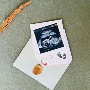 Yepyeni Bir Can Parçası Bebek Müjde Kartı – Dede İçin