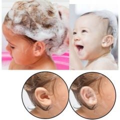 Su Geçirmez Yapışkanlı Kulak Koruyucu Bant 10 Lu Paket