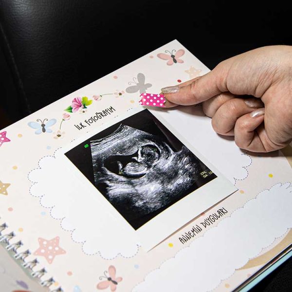 Hamilelik Ve Anne Bebek Günlüğü Pembe Anı Defteri