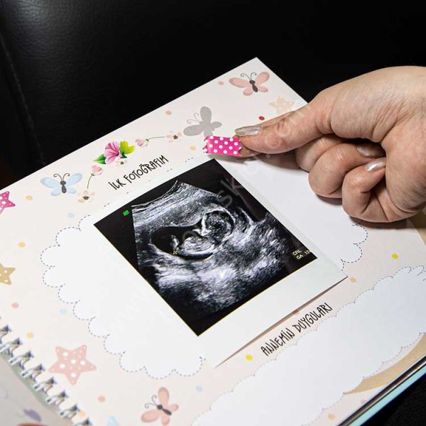 Hamilelik Ve Anne Bebek Günlüğü Mavi Anı Defteri