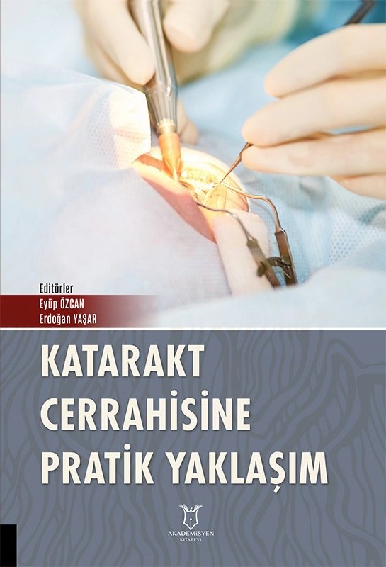 Katarakt Cerrahisine Pratik Yaklaşım