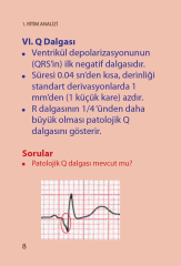 Paramedik Ekg Kartları