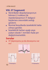 Paramedik Ekg Kartları