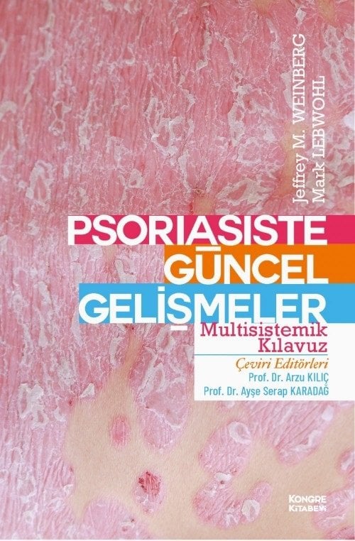 Psoriasiste Güncel Gelişmeler Multisistemik Klavuzu