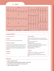 EKG'yi Anlamak (Kendinizi Değerlendirmek İçin Vakalar)