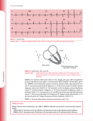 EKG'yi Anlamak (Uygulamalı Kılavuz)