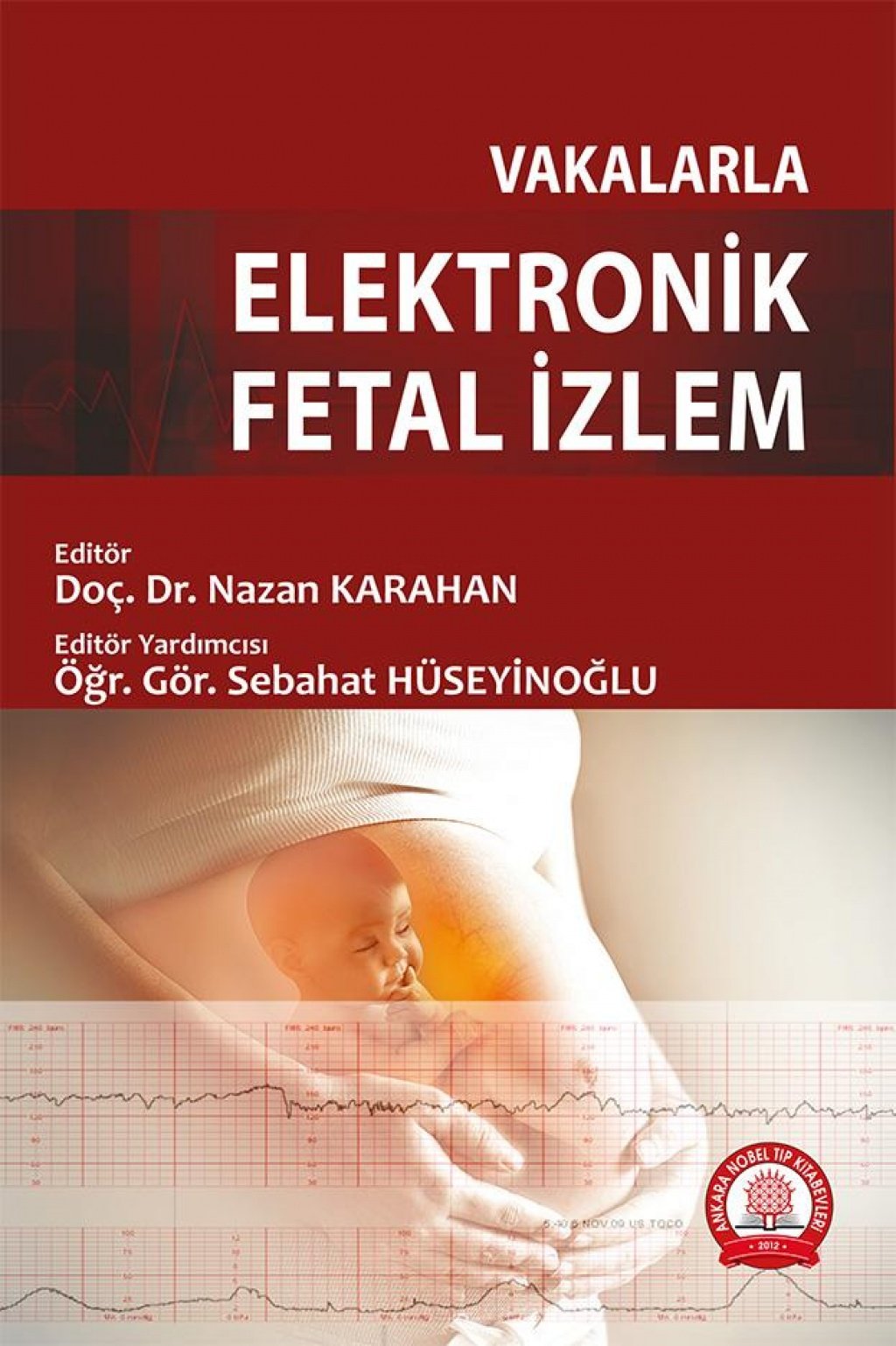 Vakalarla Elektronik Fetal İzlem