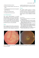 Klinik Oftalmoloji Renkli Atlas ve Genel Bakış - PEDİATRİK OFTALMOLOJİ