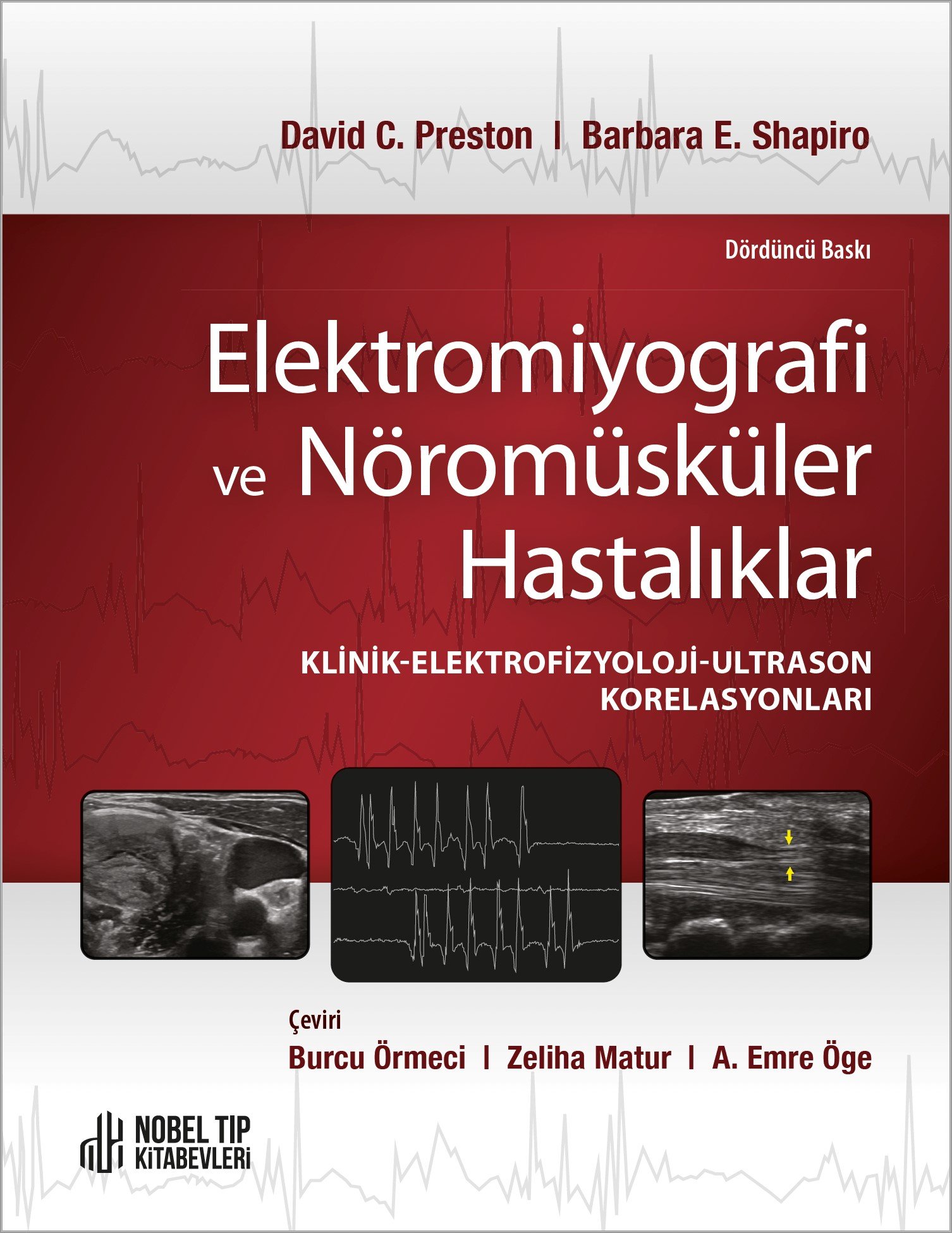 Elektromiyografi ve Nöromüsküler Hastalıklar: Klinik-Elektrofizyoloji-Ultrason Korelasyonları