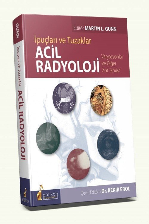 Acil Radyoloji İpuçları ve Tuzaklar