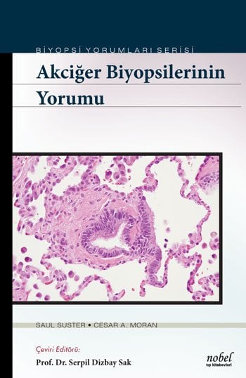 Akciğer Biyopsilerinin Yorumu - Biyopsi Yorumları Serisi