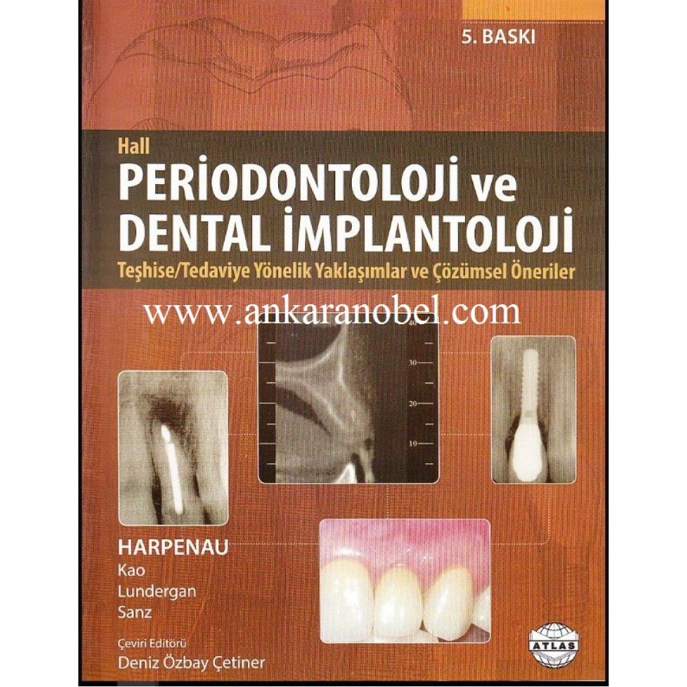 Periodontoloji ve Dental İmplantoloji - Hall