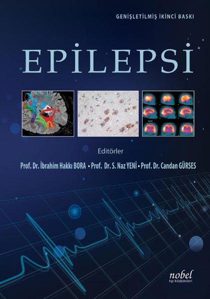 Epilepsi: Genişletilmiş İkinci Baskı