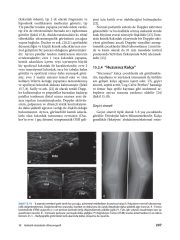 Fiziksel Tıp ve Rehabilitasyonda Kas İskelet Sistemi Ultrasonografisi