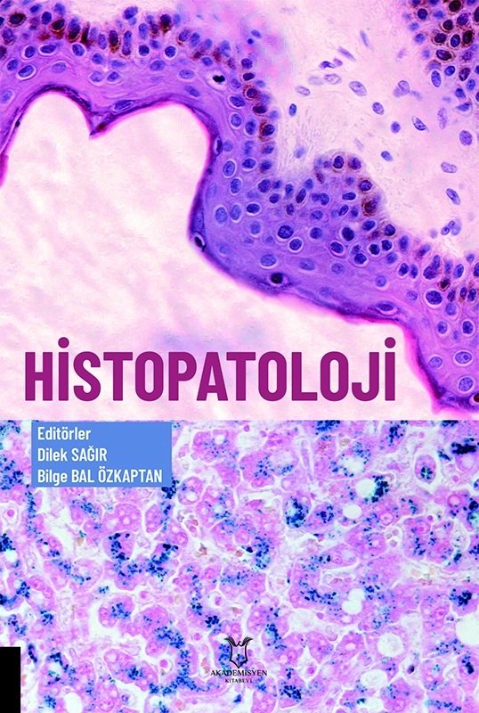 Histopatoloji
