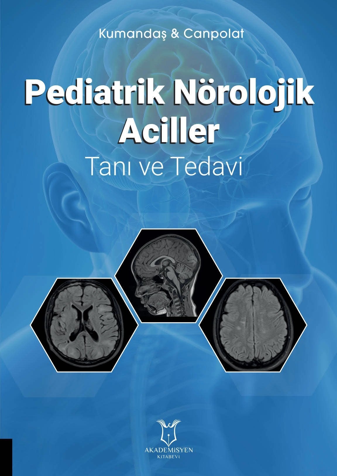Pediatrik Nörolojik Aciller Tanı ve Tedavi