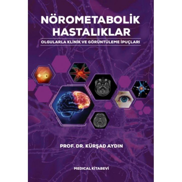 Nörometabolik Hastalıklar Prof Dr Kürşad AYDIN