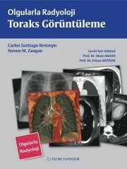 OLGULARLA RADYOLOJİ TORAKS GÖRÜNTÜLEME