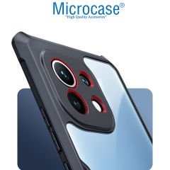 Microcase Xiaomi Mi 11 Lite Airbag Serisi Darbeye Dayanıklı Köşe Korumalı Kılıf