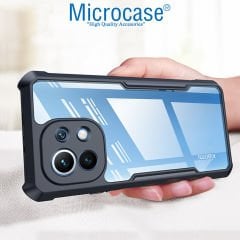 Microcase Xiaomi Mi 11 Lite Airbag Serisi Darbeye Dayanıklı Köşe Korumalı Kılıf