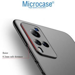 Microcase Vivo X60 Pro Elektrocase Serisi Kamera Korumalı Silikon Kılıf - Siyah