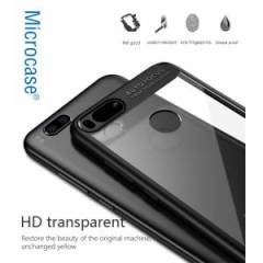 Xiaomi Mi 5X A1 Auto Focus Serisi Crystal Back Silikon Kılıf+Cam