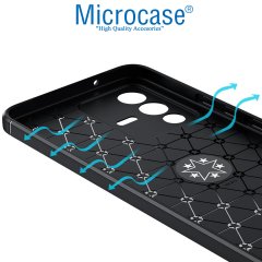 Microcase Vivo V23 5G Focus Serisi Yüzük Standlı Silikon Kılıf - Siyah