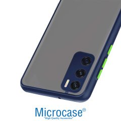 Microcase Vivo V20 SE London Serisi Darbeye Dayanıklı Kılıf - Buzlu Mavi