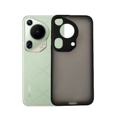 Microcase Huawei 70  Ultra London Serisi Darbeye Dayanıklı Kılıf - Siyah AL3415