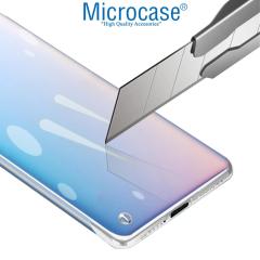 Microcase Xiaomi Mi 10S Frameless Çerçevesiz Sert Kılıf - Şeffaf