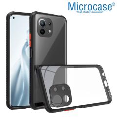 Microcase Xiaomi 11 Lite 5G NE Ball Serisi Köşe Korumalı Kılıf