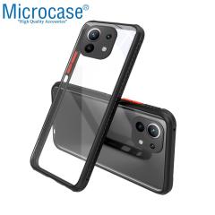 Microcase Xiaomi 11 Lite 5G NE Ball Serisi Köşe Korumalı Kılıf