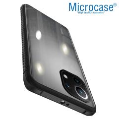 Microcase Xiaomi 11 Lite 5G NE Ball Serisi Köşe Korumalı Kılıf