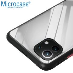 Microcase Xiaomi 11 Lite 5G NE Ball Serisi Köşe Korumalı Kılıf