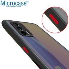 Microcase Realme GT 5G London Serisi Sert Kılıf - Buzlu Siyah