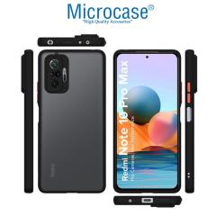 Microcase Xiaomi Redmi Note 10 Pro Max London Serisi Kılıf - Buzlu Siyah