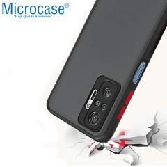 Microcase Xiaomi Redmi Note 10 Pro Max London Serisi Kılıf - Buzlu Siyah