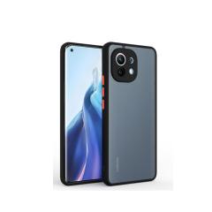 Microcase Xiaomi 11 Lite 5G NE London Serisi Sert Kılıf Buzlu Siyah