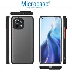 Microcase Xiaomi 11 Lite 5G NE London Serisi Sert Kılıf Buzlu Siyah
