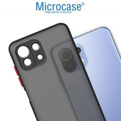 Microcase Xiaomi 11 Lite 5G NE London Serisi Sert Kılıf Buzlu Siyah