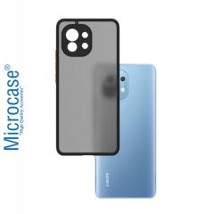 Microcase Xiaomi 11 Lite 5G NE London Serisi Sert Kılıf Buzlu Siyah