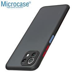 Microcase Xiaomi 11 Lite 5G NE London Serisi Sert Kılıf Buzlu Siyah