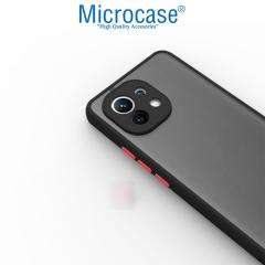 Microcase Xiaomi 11 Lite 5G NE London Serisi Sert Kılıf Buzlu Siyah