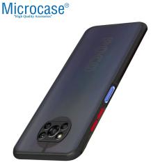Microcase Xiaomi Poco X3 NFC London Serisi Sert Kılıf Buzlu Siyah